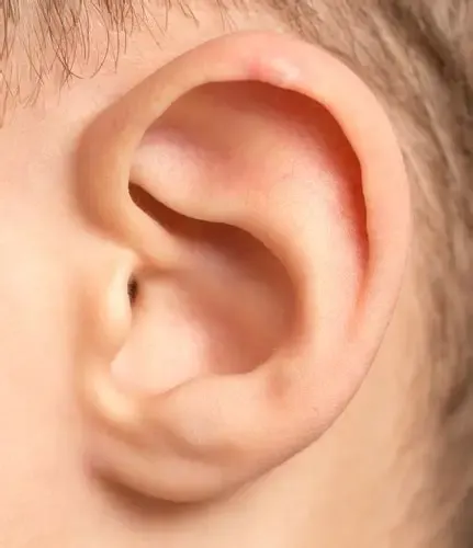 Tinnitus Fix review result no.3